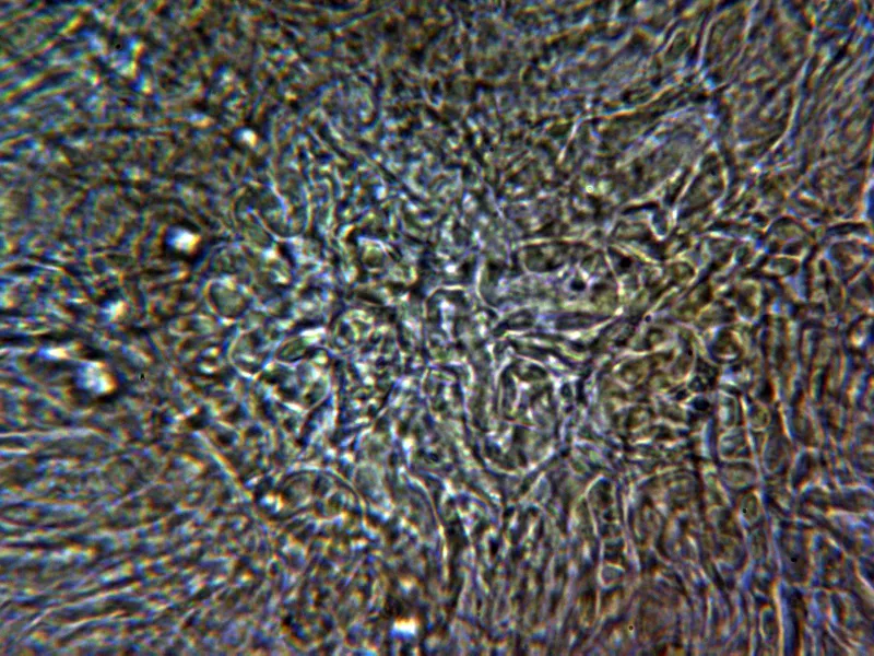 Ciboria americana 10 - Excípulo medular